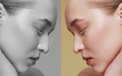 Medicina estética vs. Cirugía plástica. Diferencias médicas que debes conocer